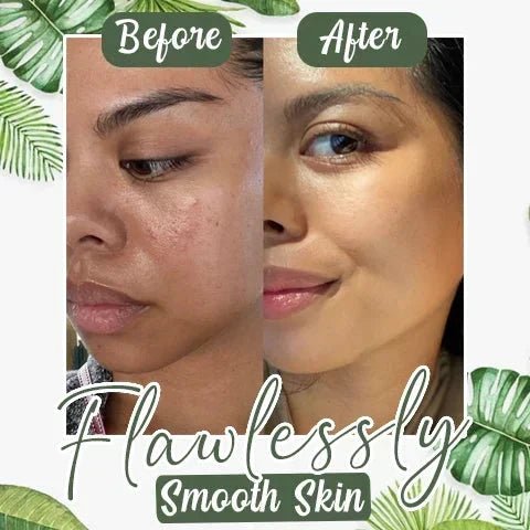 Green Mask Stick Black Head & Acne Remover - 100% Original - Image 4