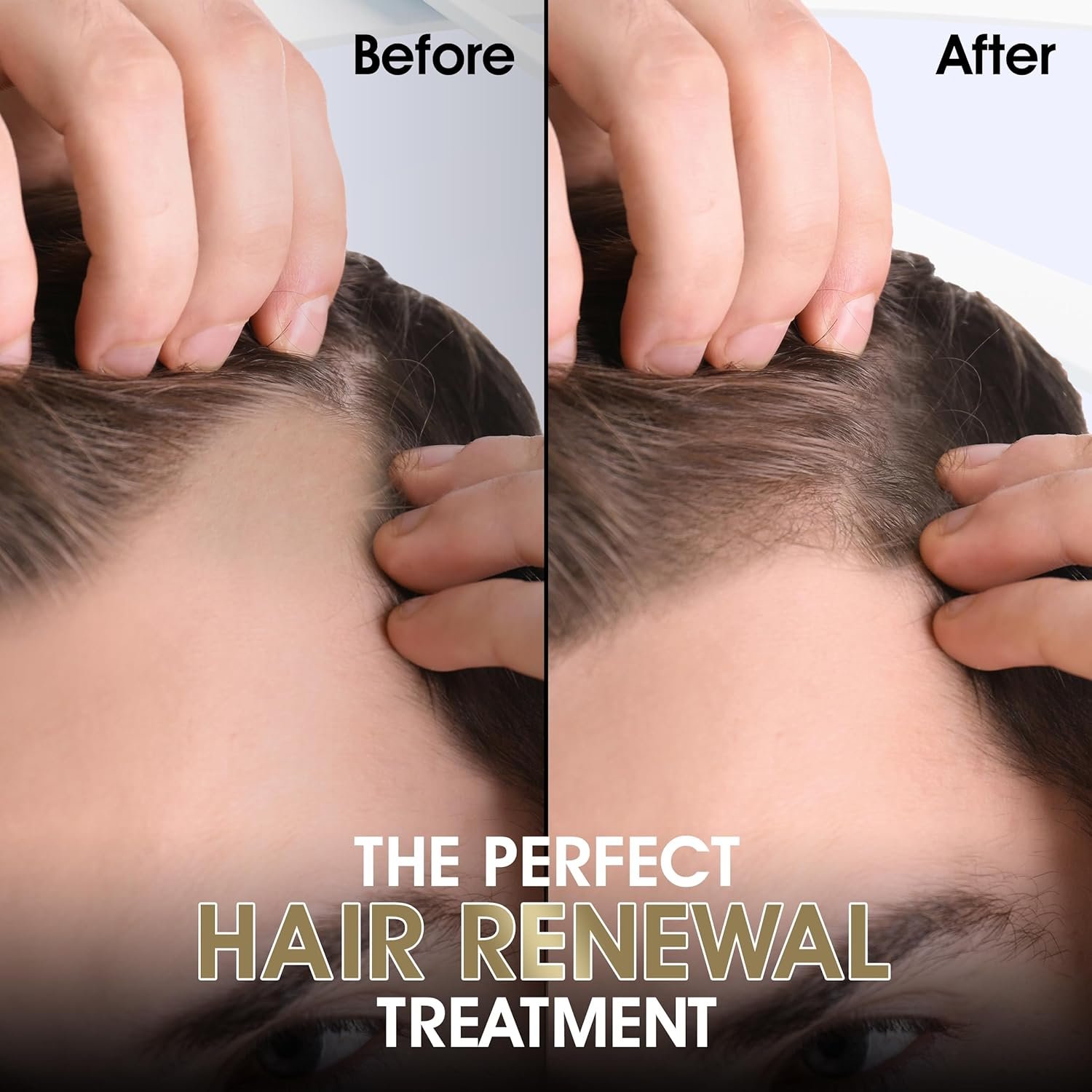 Derma Roller & Ginger Hair Oil - Image 2