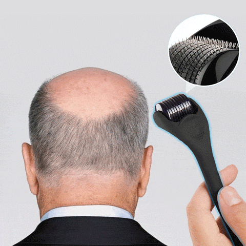 Derma Roller & Ginger Hair Oil - Image 4