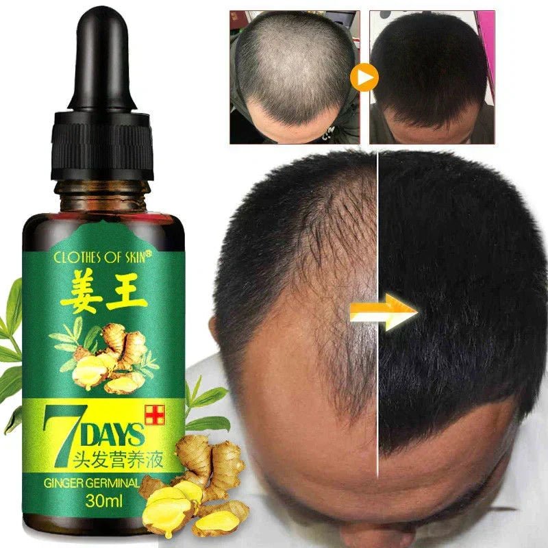 Derma Roller & Ginger Hair Oil - Image 3
