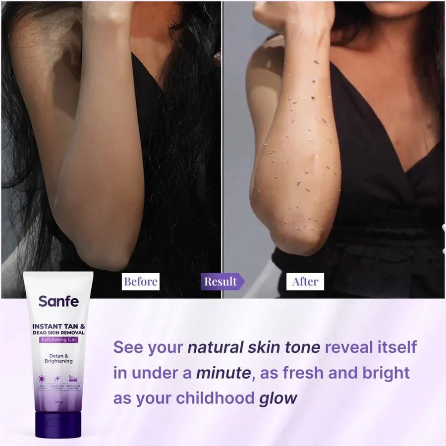 Sanfe Instant Tan & Dead Skin Removal Exfoliating Gel - Image 2